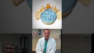 An Orthopedic Surgeon's Guide: Bulging vs Herniated Discs in the Spine #backpain #backinjury