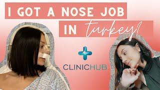 TURKEY RHINOPLASTY VLOG | My nose job with Dr. Emrah Celik