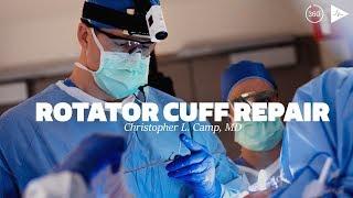 Rotator Cuff Repair by Christopher L. Camp, MD