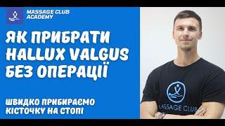 Як прибрати кісточку на стопі. Прибираємо Hallux Valgus БЕЗ ОПЕРАЦІЇ