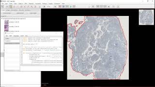 Nuclei segmentation based on stardist with QuPath