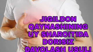 JIGILDON QAYNASHINING UY SHAROITIDA  DAVOLASH USULI ЖИГИЛДОН КАЙНАШИНИНГ УЙ ШАРОИТИДА ДАВОЛАШ УСУЛИ