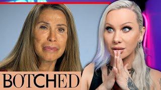 $200 Cosmetic Surgery gets BOTCHED! volume 4