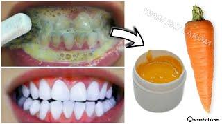 Teeth whitening in just 2 minutes - how to whiten teeth at home? 100% effective