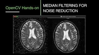 15. Median Filtering for Noise Reduction in OpenCV | OpenCV Tutorial