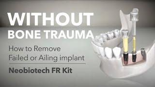 The Original Implant Removal Solution: Neobiotech FR Kit