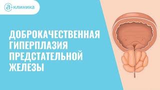 Доброкачественная гиперплазия предстательной железы