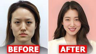 Shocking Plastic Surgery Of Korean Actresses Before and After