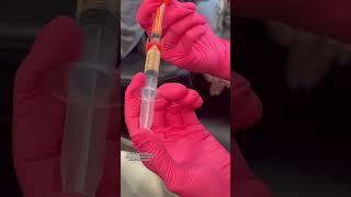 PRP vs PRF vs EZ Gel - unlocking the secrets of youthful skin with cutting-edge treatments, using
