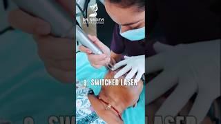 Q Switched Laser for Pigmentation | How to Improve Skin Texture on Face? | #qswitchlaser #drsridevi