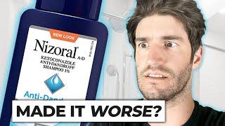 Nizoral Shampoo For Hair Loss - THE TRUTH