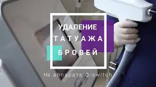  Видалення татуажу брів лазером у клініці Med City. Як відбувається процедура 