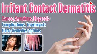 Irritant contact dermatitis overview, causes, symptoms, treatment options and home remedies