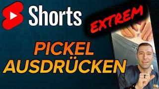 Krasser Pickel #shorts