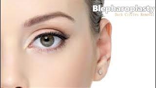  Powerful Blepharoplasty! ~ Dark Circles & Eye Bags Removal + Radiant Youthful Skin ~ Ocean Sounds