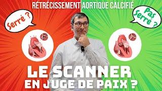 Serré ou pas serré ? Comment le SCANNER aide à l'évaluation du Rétrécissement Aortique