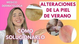 ALTERACIONES DE LA PIEL EN VERANO: DERMATÓLOGA EXPLICA CÓMO SOLUCIONAR MANCHAS, PIEL IRRITADA...