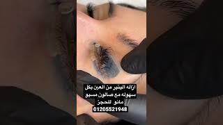 ازاله وشم العين مع صالون مسيو مانو للحجز 01205521948