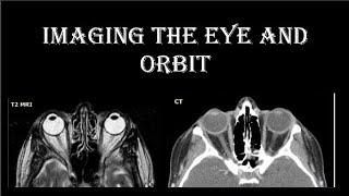 CT MRI eye and  orbit