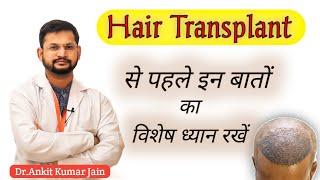 Pre Hair Transplant Instructions By Dr.Ankit Kumar Jain || Before Hair Transplant Tips.