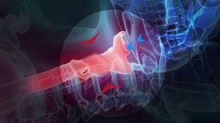 How does the Snoreeze Oral Device treat snoring?