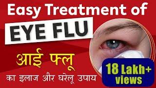 Eye Flu Treatment | Conjunctivitis - Cause, Prevention & Treatment | आई फ्लू का इलाज और घरेलू उपाय |