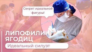 ЛИПОФИЛИНГ ЯГОДИЦ / УВЕЛИЧЕНИЯ ЯГОДИЦ СОБСТВЕННМ ЖИРОМ #абриелль #левицкая