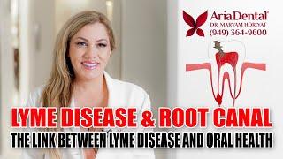 Lyme Disease and Root Canal | Aria Dental | Maryam Horiyat DDS.