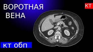 Лучевая анатомия воротной вены