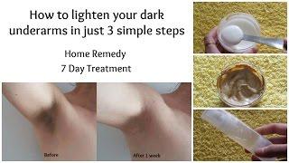 How to whiten dark underarms in just 7 days | Home remedy