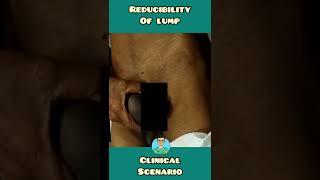 Reducibility of lump | Clinical scenario | #shorts