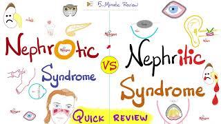 Nephrotic AND Nephritic Syndrome - Quick Review - Nephrology & Pathology