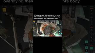 Follow for more! #tech #news #breakingnews #viral #robot #ai #doctor #3d #technology