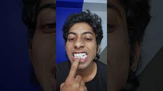 Teeth Whitening In Just 30 min #fyp #diy #lifehacks #experiment