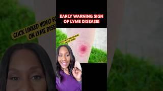 WARNING SIGN OF LYME DISEASE YOU SHOULD NEVER IGNORE #shorts #shortsfeed #shortsvideo
