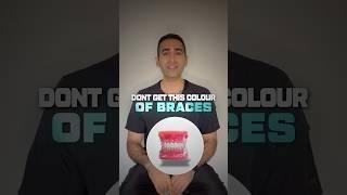 Avoid this color of braces unless you want your teeth to look yellow 
