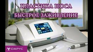 Пластика носа Алматы. Быстрое восстановление