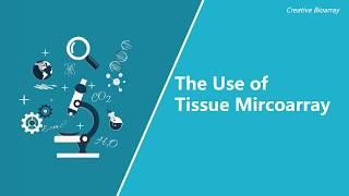 The Use of tissue array