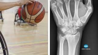 Explore Wrist Motion in Sports with Dynamic Digital Radiography (DDR) | Konica Minolta Healthcare