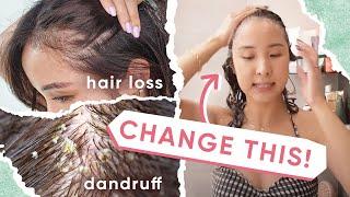 4 Reasons WHY Your Hair Loss & Dandruff ISN’T Getting BETTER + 5 TIPS!