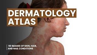 Dermatology Atlas