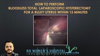 #202 : HOW TO PERFORM BLOODLESS TOTAL LAPAROSCOPIC HYSTERECTOMY FOR A BULKY UTERUS WITHIN 15 MINUTES