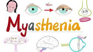 Myasthenia Gravis (MG) - Muscle weakness & Fatigue - Causes, Symptoms, Diagnosis, Treatment - Neuro