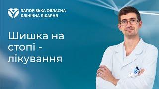 Шишка на стопі - лікування в Запоріжжі