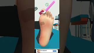 Foot clinic game video #short video #foot clinic