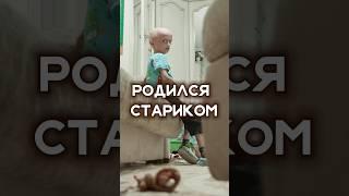 ПОЧЕМУ РЕБЁНОК ВЫГЛЯДИТ КАК СТАРИК? Опасное заболевание #shorts #прогерия #особыедети