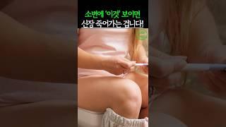 소변에 이것 보이면 신장이 죽어가는 겁니다! #건강 #건강정보