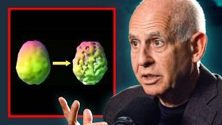 This Is What Alcohol & Marijuana Do To Your Brain - Dr Daniel Amen