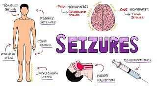 Seizures - Seizure Types | Generalized vs Focal Seizures | Causes of Seizures (Mnemonic)