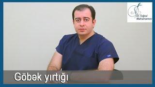 Göbək yırtığı